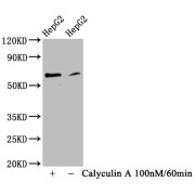 Western Blot<br/> Positive WB detected in: HepG2 whole cell lysate (treated with Calyculin A or not)<br/> All lanes: Phospho-YAP1 antibody at 0.83 µg/ml<br/> Secondary<br/> Goat polyclonal to rabbit IgG at 1/50000 dilution<br/> Predicted band size: 65 KDa<br/> Observed band size: 65 KDa<br/>