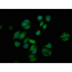 RAF1 (pS259) Antibody