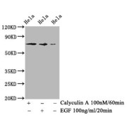 Western Blot<br/> Positive WB detected in: Hela whole cell lysate(treated with Calyculin A or EGF)<br/> All lanes: Phospho-RAF1 antibody at 1.18 µg/ml<br/> Secondary<br/> Goat polyclonal to rabbit IgG at 1/50000 dilution<br/> Predicted band size: 73 KDa<br/> Observed band size: 73 KDa<br/>