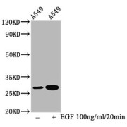 Western Blot<br/> Positive WB detected in: A549 whole cell lysate(treated with EGF or not)<br/> All lanes: Phospho-HSPB1 antibody at 1.5 µg/ml<br/> Secondary<br/> Goat polyclonal to rabbit IgG at 1/50000 dilution<br/> Predicted band size: 27 KDa<br/> Observed band size: 27 KDa<br/>