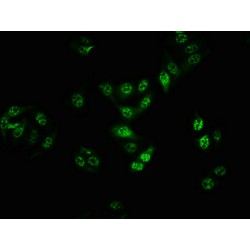 B-Raf Proto Oncogene Serine/Threonine Protein Kinase Phospho-Thr401 (BRAF pT401) Antibody