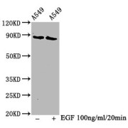 Western Blot<br/> Positive WB detected in: A549 whole cell lysate (treated with EGF or not)<br/> All lanes: Phospho-BRAF antibody at 1.3 µg/ml<br/> Secondary<br/> Goat polyclonal to rabbit IgG at 1/50000 dilution<br/> Predicted band size: 85 KDa<br/> Observed band size: 85 KDa<br/>