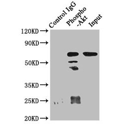 RAC-Alpha Serine/threonine-Protein Kinase Phospho-Ser473 (AKT1 pS473) Antibody