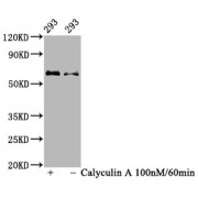 Western Blot<br/> Positive WB detected in: 293 whole cell lysate(treated with Calyculin A or not)<br/> All lanes: Phospho-AKT1 antibody at 1.08 µg/ml<br/> Secondary<br/> Goat polyclonal to rabbit IgG at 1/50000 dilution<br/> Predicted band size: 60 KDa<br/> Observed band size: 60 KDa<br/>