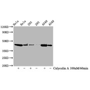 Western Blot<br/> Positive WB detected in: Hela whole cell lysate,293 whole cell lysate,A549 whole cell lysate (treated with Calyculin A or not)<br/> All lanes: Phospho-GSK3B antibody at 0.77 µg/ml<br/> Secondary<br/> Goat polyclonal to rabbit IgG at 1/50000 dilution<br/> Predicted band size: 46 KDa<br/> Observed band size: 46 KDa<br/>