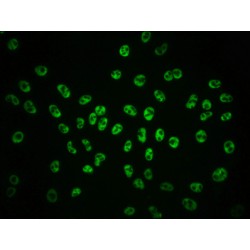 POLR2A (pS2) Antibody