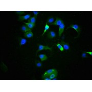 Immunofluorescence staining of MCF-7 cells using TP53 (pS9) Antibody at 1/100, counter-stained with DAPI. The cells were fixed in 4% formaldehyde, permeabilized using 0.2% Triton X-100 and blocked in 10% normal Goat Serum. The cells were then incubated with the antibody overnight at 4°C. The secondary antibody was AF488-congugated AffiniPure Goat Anti-Rabbit IgG (H+L).