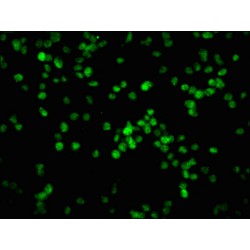 Retinoblastoma Protein 1 Phospho-Ser780 (RB1) Antibody