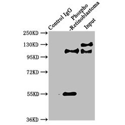 Retinoblastoma Protein 1 Phospho-Ser780 (RB1) Antibody