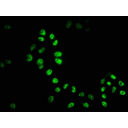 HDAC9 Antibody