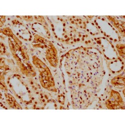 HDAC9 Antibody