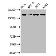 Western Blot<br/> Positive WB detected in: Hela whole cell lysate, MCF-7 whole cell lysate, 293T whole cell lysate, K562 whole cell lysate<br/> All lanes: HDAC9 antibody at 1.54 µg/ml<br/> Secondary<br/> Goat polyclonal to rabbit IgG at 1/50000 dilution<br/> Predicted band size: 112, 102, 66, 98, 118, 113, 61, 63, 58 KDa<br/> Observed band size: 160 KDa<br/>