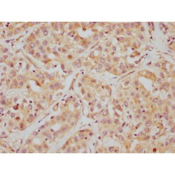 HDAC6 Antibody