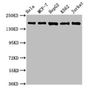 Western Blot<br/> Positive WB detected in: Hela whole cell lysate, MCF-7 whole cell lysate, HepG2 whole cell lysate, K562 whole cell lysate, Jurkat whole cell lysate<br/> All lanes: HDAC6 antibody at 1.1 µg/ml<br/> Secondary<br/> Goat polyclonal to rabbit IgG at 1/50000 dilution<br/> Predicted band size: 132, 115 KDa<br/> Observed band size: 160 KDa<br/>