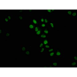 FTO Antibody