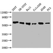 Western Blot<br/> Positive WB detected in: 293T whole cell lysate, SH-SY5Y whole cell lysate, Raji whole cell lysate, Colo320 whole cell lysate, A549 whole cell lysate, PC3 whole cell lysate<br/> All lanes: FTO antibody at 0.7 µg/ml<br/> Secondary<br/> Goat polyclonal to rabbit IgG at 1/50000 dilution<br/> Predicted band size: 59, 15, 7, 13 KDa<br/> Observed band size: 59 KDa<br/>