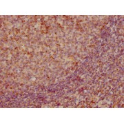 Immunocytochemistry analysis of CCL19 Antibody diluted at 1/155 and staining in paraffin-embedded human tonsil tissue. After dewaxing and hydration, antigen retrieval was mediated by high pressure in a citrate buffer (pH 6.0). Section was blocked with 10% normal goat serum 30min at RT. Then primary antibody (1% BSA) was incubated at 4°C overnight. The primary is detected by a biotinylated secondary antibody and visualized using an HRP conjugated SP system.