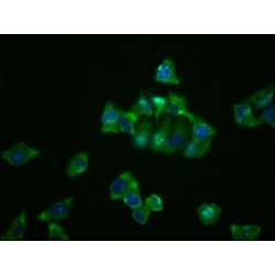 NDRG1 Antibody