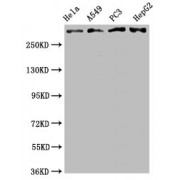 Western Blot<br/> Positive WB detected in: Hela whole cell lysate, A549 whole cell lysate, PC3 whole cell lysate, HepG2 whole cell lysate<br/> All lanes: ATM antibody at 2.05 µg/ml<br/> Secondary<br/> Goat polyclonal to rabbit IgG at 1/50000 dilution<br/> Predicted band size: 350 KDa<br/> Observed band size: 350 KDa<br/>