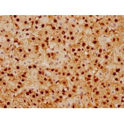 Immunohistochemistry analysis of SUMO1 Antibody diluted at 1/92.5 and staining in paraffin-embedded human adrenal gland tissue. After dewaxing and hydration, antigen retrieval was mediated by high pressure in a citrate buffer (pH 6.0). Section was blocked with 10% normal goat serum 30min at RT. Then primary antibody (1% BSA) was incubated at 4°C overnight. The primary is detected by a biotinylated secondary antibody and visualized using an HRP conjugated SP system.