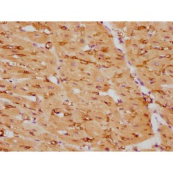 Calponin 1 (CNN1) Antibody