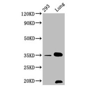 Western Blot<br/> Positive WB detected in: 293 whole cell lysate, Mouse lung tissue<br/> All lanes: CNN1 antibody at 1.05 µg/ml<br/> Secondary<br/> Goat polyclonal to rabbit IgG at 1/50000 dilution<br/> Predicted band size: 34, 32 KDa<br/> Observed band size: 34 KDa<br/>