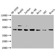 Western Blot<br/> Positive WB detected in: SH-SY5Y whole cell lysate, HepG2 whole cell lysate, Jurkat whole cell lysate, HL-60 whole cell lysate, Hela whole cell lysate, U87 whole cell lysate, Mouse brain tissue<br/> All lanes: CCR9 antibody at 1 µg/ml<br/> Secondary<br/> Goat polyclonal to rabbit IgG at 1/50000 dilution<br/> Predicted band size: 43, 41 KDa<br/> Observed band size: 43 KDa<br/>