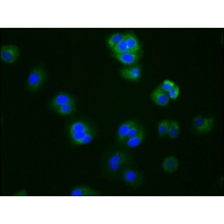 Aromatase (CYP19A1) Antibody