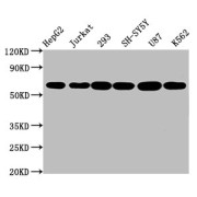 WB analysis of (1) HepG2 whole cell lysate, (2) Jurkat whole cell lysate, (3) 293 whole cell lysate, (4) SH-SY5Y whole cell lysate, (5) U87 whole cell lysate, and (6) K562 whole cell lysate, using CYP19A1 antibody (2.3 µg/ml) and goat anti-rabbit IgG (1/50000 dilution). Predicted band size: 58, 25 kDa, Observed band size: 58 kDa.