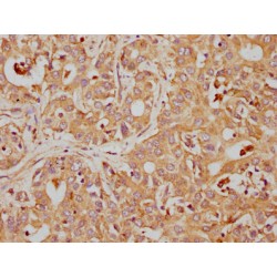 CD63 Antigen (CD63) Antibody
