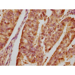 Heat Shock Protein HSP 90-Alpha (HSP90AA1) Antibody