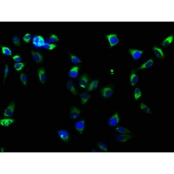 Integrin Beta 1 (ITGB1) Antibody