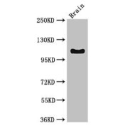 WB analysis of Mouse brain tissue, using DSG3 antibody (3 µg/ml). Predicted band size: 108 kDa and Observed band size: 108 kDa.