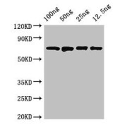 WB analysis of recombinant danK, using dnaK antibody (2.8 µg/ml). Predicted band size: 70 kDa. Observed band size: 70 kDa.