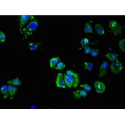 Immunofluorescence analysis of MCF-7 cells using ADRB3 antibody (1/100 dilution).