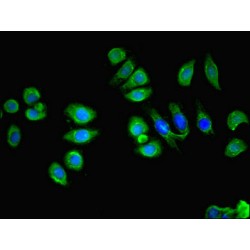 Lymphocyte Antigen 6 Complex Locus E (LY6E) Antibody