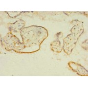 IHC-P analysis of human placenta tissue, using ITIH5 Antibody (1/100 dilution).