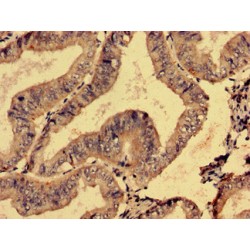 Telomerase-Binding Protein EST1A (SMG6) Antibody