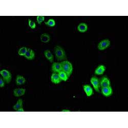 Ileal Sodium/Bile Acid Cotransporter (SLC10A2) Antibody