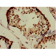 Immunohistochemistry analysis of paraffin-embedded Human testis tissue, using IZUMO1 antibody (1/100 dilution).