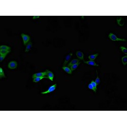 Organic Solute Transporter Subunit Alpha (SLC51A) Antibody