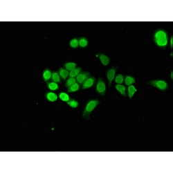 Nuclear Protein 1 (NUPR1) Antibody