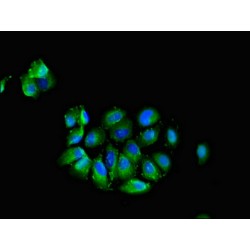 Cell Adhesion Molecule 3 (CADM3) Antibody