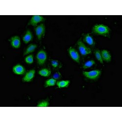 Plexin D1 (PLXND1) Antibody