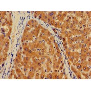 Immunohistochemistry analysis of paraffin-embedded Human liver tissue, using PLXND1 antibody (1/100 dilution).