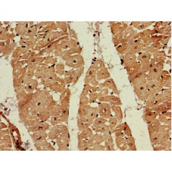 Farnesyl Diphosphate Synthase (FDPS) Antibody