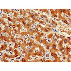 Farnesyl Diphosphate Synthase (FDPS) Antibody