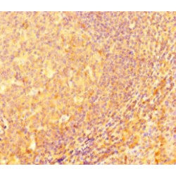 Interferon Regulatory Factor 5 (IRF5) Antibody