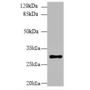 HLA Class II Histocompatibility Antigen, DR Beta 4 Chain (HLA-DRB4) Antibody