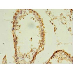 Exosome Component 5 (EXOSC5) Antibody